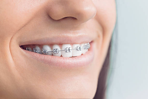 Best Dental Fillings (Composite and Amalgam)  in Frazer, PA